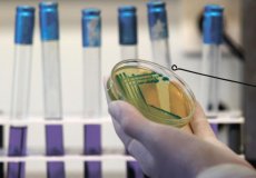 Что такое экссудат и транссудат в медицине? Их причины и отличия